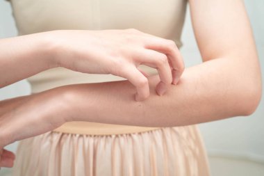 El kaşıma kullanarak cilt hastalıklarından kaşınan Asyalı kadın.