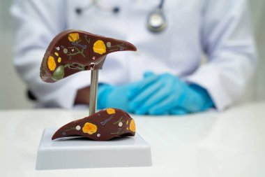 Safra kesesi, pankreas dalağı ve onikiparmak bağırsağı olan karaciğer, Asyalı doktor hastanede teşhis ve tedavi için insan anatomisi modeli tutuyor..