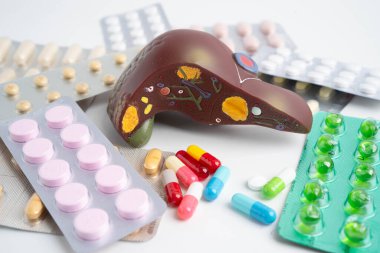 Hap tedavisi gören karaciğer modeli, siroz, karaciğer kanseri, yağlı karaciğer..