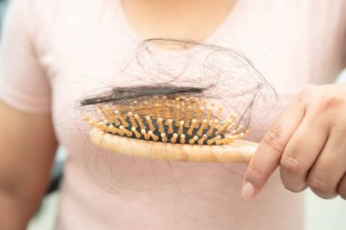 Asyalı kadınların tarak fırçasına eklenen uzun saç kaybıyla ilgili sorunları var..