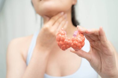 Hipertiroidizm, aşırı aktif tiroid, tiroid lenfoma, tiroid bezi insan anatomisi olan Asyalı kadın..