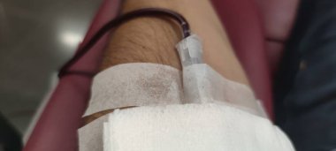 Kateterli bir kol görüntüsü kırmızı kanla dolu. Kan bağışı fotoğrafı çekiyor.