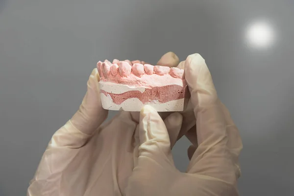 dentist checks a mold-shaped plaster denture in the dental clinic waiting to be checked by the patient