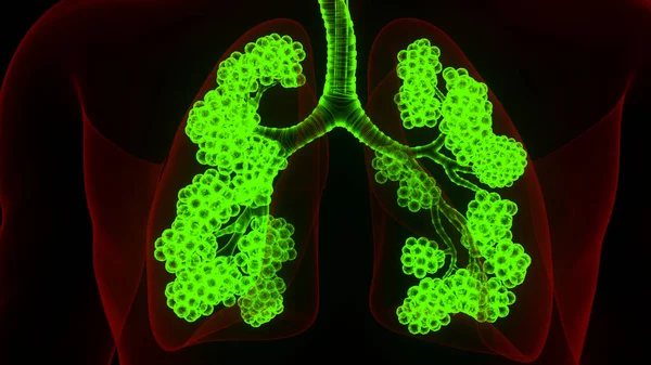 Sistema Respiratorio Umano Polmoni Con Anatomia Alveoli — Foto Stock