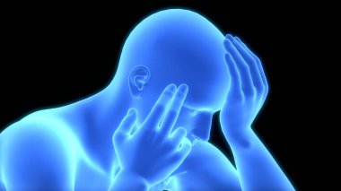 Şiddetli Baş Ağrısı Anatomisi ile İnsan Izdırabının Üç Boyutlu İllüstrasyonu
