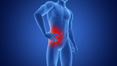 Kalça Anatomisi 'nde Şiddetli Ağrı Olan İnsan Acı Kavramının 3 boyutlu çizimi