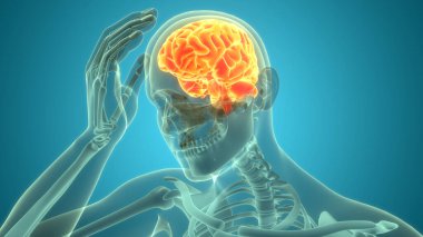 Şiddetli Baş Ağrısı Anatomisi ile İnsan Izdırabının Üç Boyutlu İllüstrasyonu