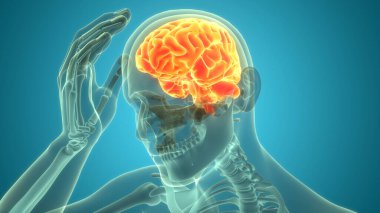 Şiddetli Baş Ağrısı Anatomisi ile İnsan Izdırabının Üç Boyutlu İllüstrasyonu