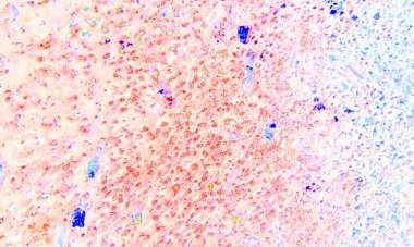 Soyut Karanlık Efekti Koyu Pembe Efekt Duvarın Doku Efekti Duvar Kağıdı. Soyut arka plan lüks, zengin, eski, zarif, antika duvar tasarımı. Soğuk modda soyut, çirkin duvar kaplaması..