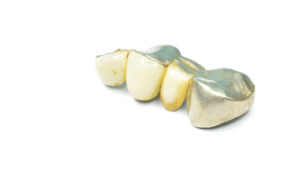 Coroa Dental Vintage Feita Porcelana Metal Sobre Fundo Branco Fotografia De Stock