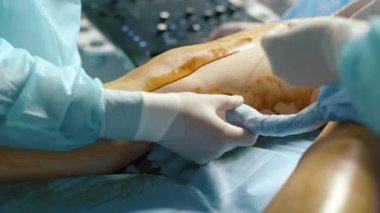 Bir klinikte damar ameliyatı yapan bir cerrah.