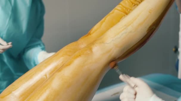 静脉手术前穿蓝色外套 戴白色手套的医生在腿上涂碘酒 — 图库视频影像
