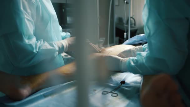 Chirurgie Veineuse Dans Une Clinique Médicale — Video