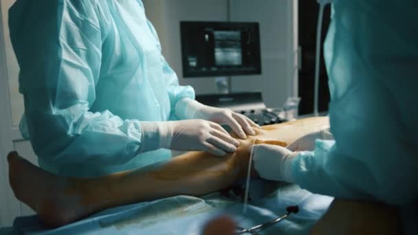Wykonywanie Zabiegu Chirurgicznego Żyły Klinice Medycznej — Wideo stockowe