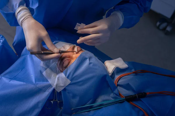 Close Eyes Eye Surgery Blepharoplasty Operation Plastic Surgeon — Stock Photo, Image