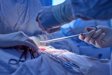 Cerrahi operasyon yakın, seçici odaklanma