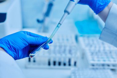 Kadın doktor ellerinde hasta analizi olan bir test tüpü tutuyor. Tıbbi muayene, seçici odaklanma.