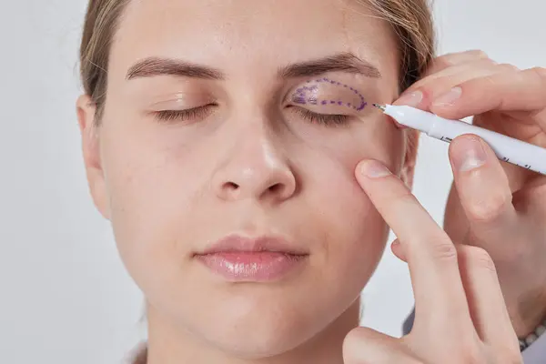 Plastik cerrah Blepharoplasty ve Blepharoplasty ameliyatına hazırlanıyor.