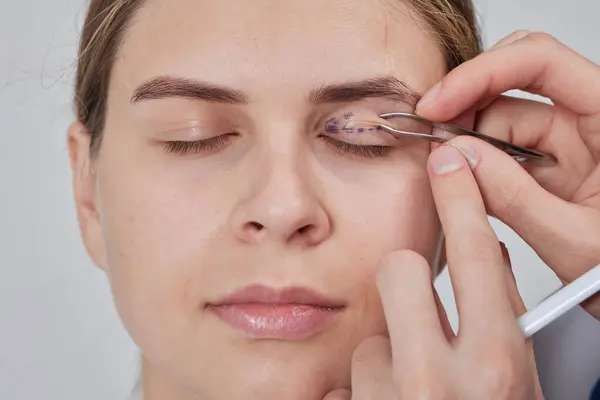 Plastik cerrah Blepharoplasty ve Blepharoplasty ameliyatına hazırlanıyor.
