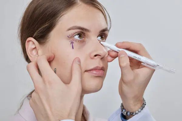 Plastik cerrah Blepharoplasty ve Blepharoplasty ameliyatına hazırlanıyor.