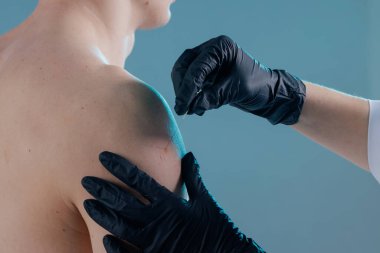 Bir uzmanın hastanın omzuna ince bir iğne soktuğu akapunktur terapisi seansı. Acıyı dindirmek ve iyileştirmek için geleneksel Çin ilaçları. kuru iğne