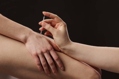 Kuru iğneleme metodu. Elinde akapunktur terapisi, uygulayıcı ağrı kesici, bütünsel iyileşme ve alternatif tıp için basınç noktasına ince bir iğne sokuyor..