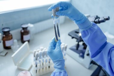 Laboratuvar teknisyeni, laboratuvar ortamında araştırma ve klinik teşhisler için mikrobiyolojik kültürlerle test tüplerini inceliyor.