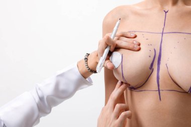 Cerrah meme büyütme ameliyatından önce hastayı hazırlar ve işaretler ve göğüs şeklini düzeltir.