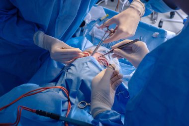 Cerrahlar steril klinikteki kozmetik prosedürü gösteren tam bir göz kapağı ameliyatı yapıyorlar.