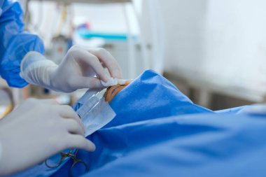 Blepharoplasty, kusurları düzeltmek için estetik ameliyat, deformasyonlar, ve göz kapaklarında defigürasyonlar ve yüz estetik olarak değişiklik için. Klinikte.