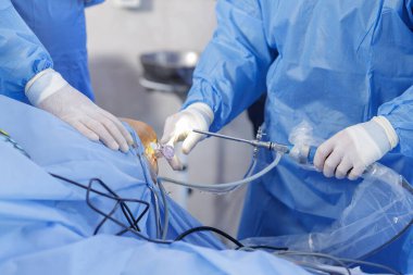 Cerrahlar artroskopi için artroskop ve steril ortopedik cerrahi ayarları kullanarak PCL rekonstrüksiyonu uygularlar.