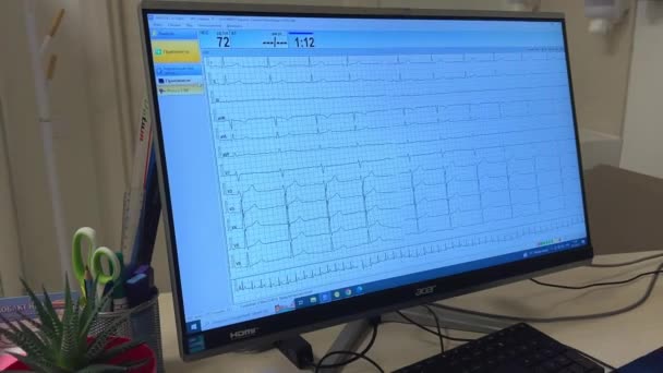 Hjärtslag Hjärtklappning Elektrokardiogram Heartbeat Lone Kardiogram Vacker Sjukvård Medicinsk Bakgrund — Stockvideo