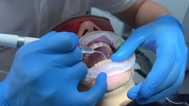 Steril eldiven diş kliniği. Bir erkek doktor başka bir adamın dişlerini fırçalıyor. Elinde özel bir yüksek teknoloji aleti var.
