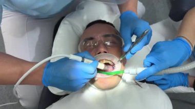 Diş muayenehanesinde bir adam ağzı açık bir şekilde sandalyeye uzanır kamera yavaşça yukarı çıkar dişlerini fırçalama sürecini filme alır bir hemşire ve bir doktor mavi giyinir.