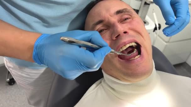 Homem Adulto Suéter Branco Senta Uma Cadeira Dentária Ele Abre — Vídeo de Stock