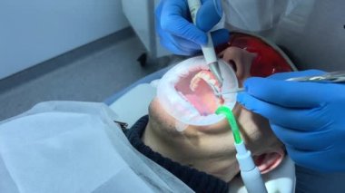 Steril eldiven diş kliniği. Bir erkek doktor başka bir adamın dişlerini fırçalıyor. Elinde özel bir yüksek teknoloji aleti var.