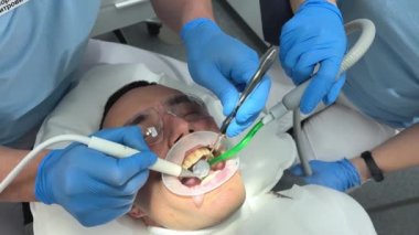 teeth cleaning middle-aged man plaque calculus in mouth lip and cheek retractor doctors 4 hands cleaning teeth suction plaque on teeth visible teeth gums treatment dental office latest technology