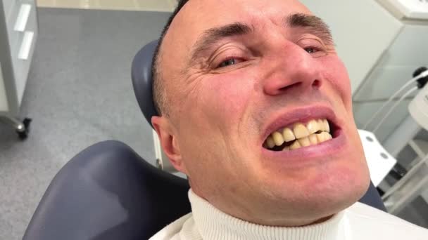 Yellow Teeth Need Dentist Man Showing His Teeth Camera — Stockvideo