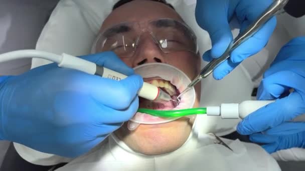 Doctor Blue Gloves Applies Ointment Patients Teeth Shows Plaque Needs — Video