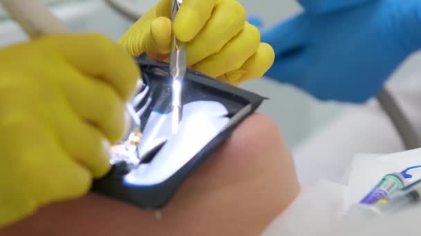 現代の歯科機器歯科顕微鏡を用いた女性歯科用マスク手袋の中程度のショット患者の歯医者の患者補助歯科治療義歯運河充填偽の歯 — ストック動画