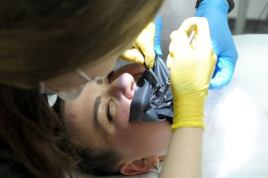 cofferdam clamp for cofferdam The process of dental prosthetics using microscope, female doctor in yellow gloves, patient dentist with patient, using dental curing light