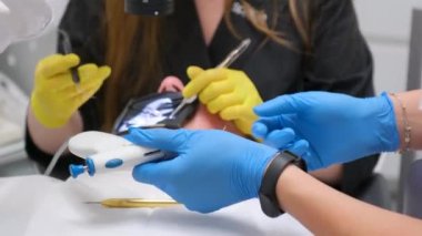 Dentistry hands of a doctor and paramedic assistant in yellow and blue gloves a bedside table with tools tray, cofferdam tongs, clamp, mirror, petri dishes with instruments, cofferdam
