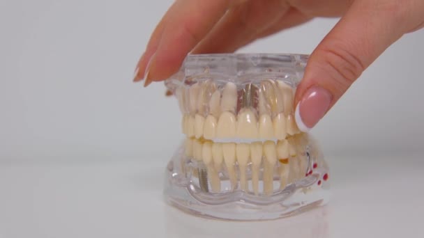 Jaw Model Demonstrate All Dental Diseases Plastic Teeth Woman Hand — Stockvideo