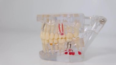 Mock-up Jaws on white background reflection teeth skeleton plastic implant educational object dental clinic prosthetics removable teeth space for text latest technology shown how to treat gum canals