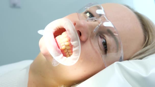 Γυναίκα Οδοντιατρική Καρέκλα Συσπειρωτήρα Στο Στόμα Κρατώντας Χείλη Για Οδοντιατρικές — Αρχείο Βίντεο