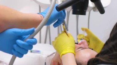 Diş mikroskobuyla ağzını açan kadın hasta ve diş hekimi ve hemşire dişlerini mikroskop kullanarak tedavi eden profesyonel bir dişçi.