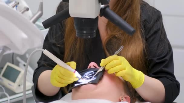 Expensive Dental Treatment Using Microscope Filling Canals Special Electronic Instruments — Stockvideo