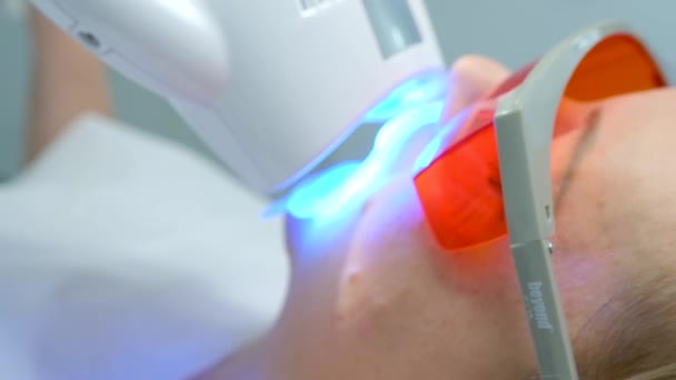 Poza Poluse Zaawansowany System Wybielania Urządzeniem Wybielania Laserowego Oka Jest — Wideo stockowe