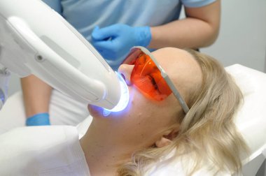 close-up of a womans face under apparatus Beyond Poluse Plus Advanced Whitening System with Dental UV Laser Whitening Device in glasses protective against ultraviolet whitening teeth