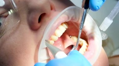 close-up woman dentistry brushing teeth cleaning removing plaque stones saliva ejector using oral mirrors newest technology sandblaster goggles water drops spilling to sides optragate mouth expander